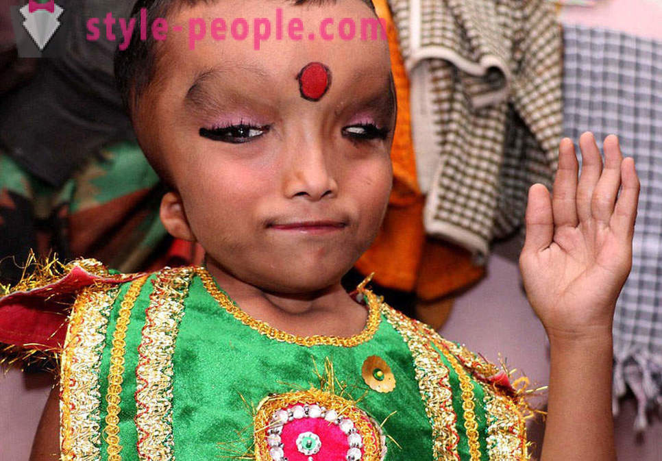 Indyjski wieś jest czczony chłopca ze zdeformowaną głową, boga Ganesha