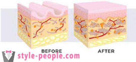 Cream „Skin Active” do twarzy z kwasem hialuronowym: Podręcznik i opinie