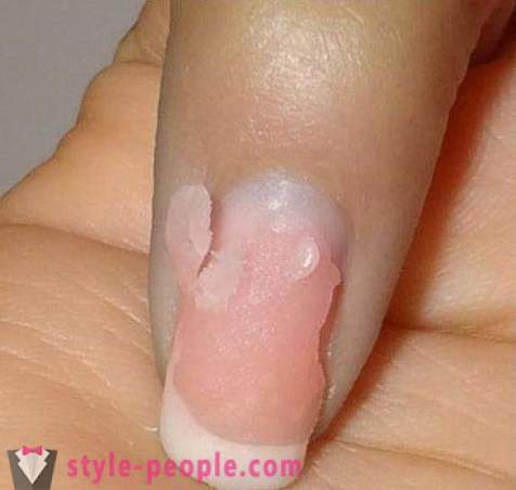 Jak usunąć paznokcie akrylowe w domu? Usuwanie paznokcie akrylowe: opinie